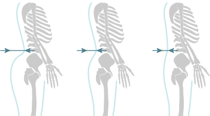 EDS床墊,腰臀比